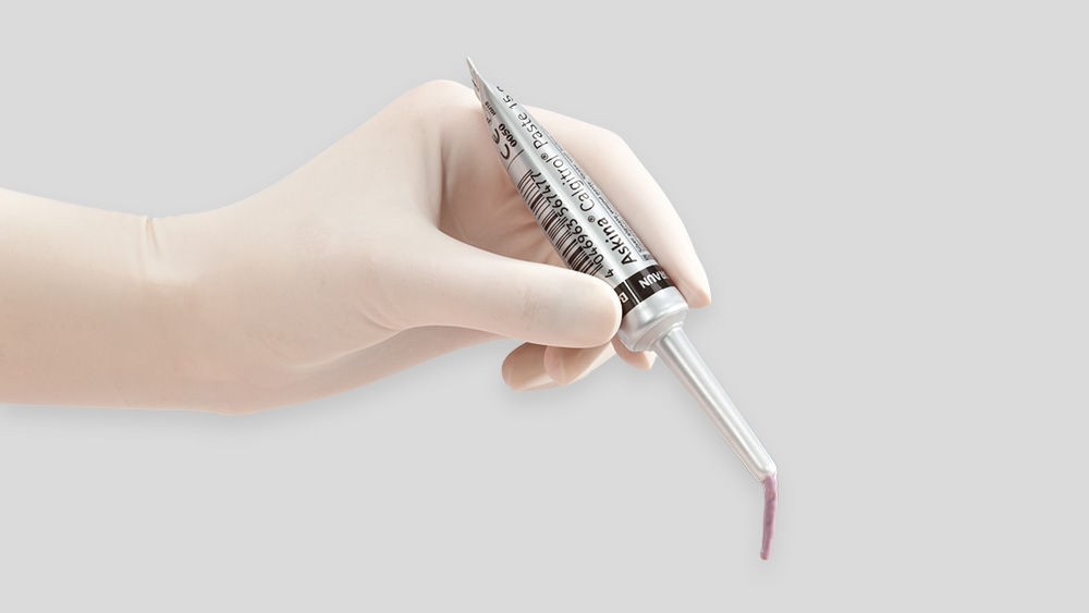 Askina® Calgitrol® Paste in der Anwendung.