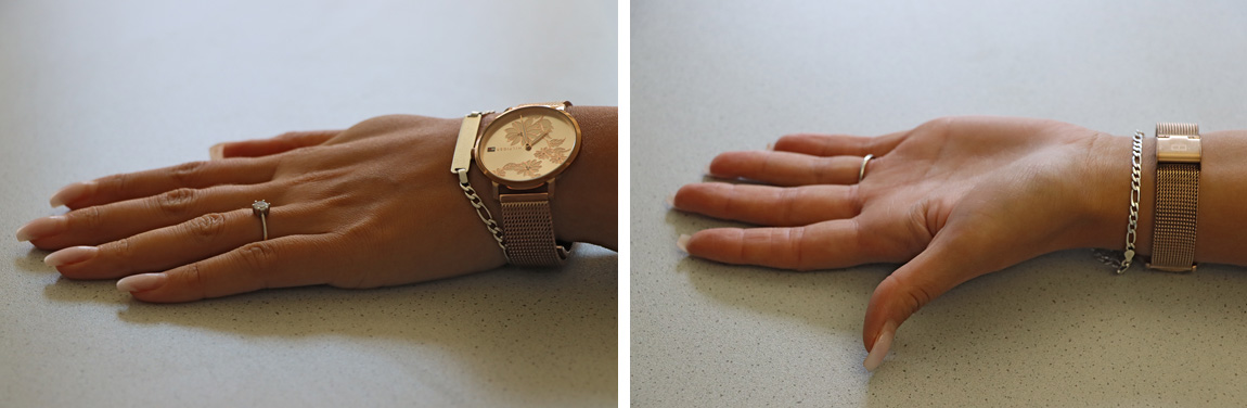 Abb.: Falsch – Schmuck und künstliche Fingernägel, Fingernägel ragen über die Fingerkuppe