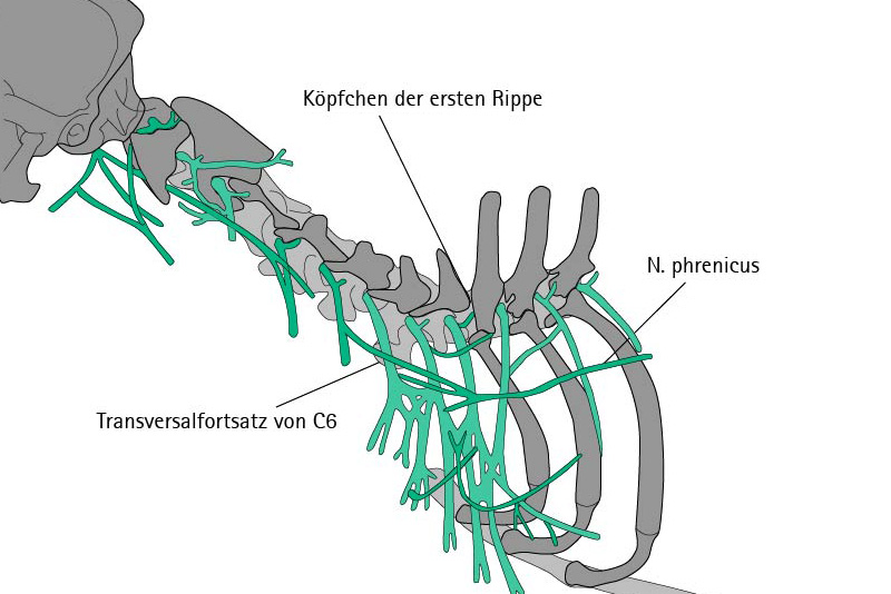 Plexus-Brachialis-Block