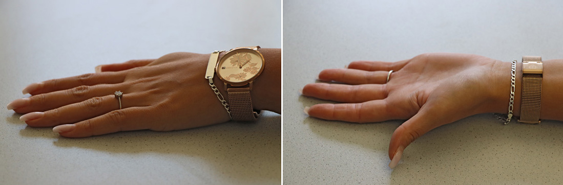 Referenzbilder zeigen Hände mit Ringen, einer Uhr und künstlichen Fingernägeln, die als möglichst zu vermeiden gekennzeichnet sind. 